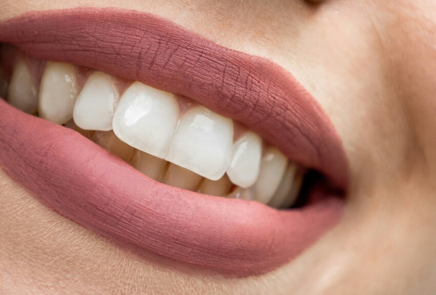 Dental Bridges